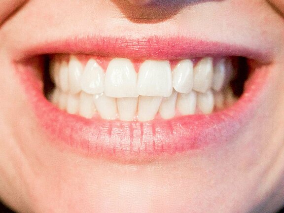 Laecheln_und_Lachen_2.jpg 