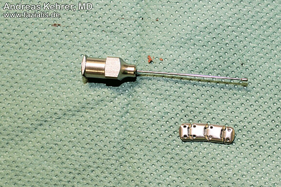 Gold_Platinimplantate_Auge_3.jpg 