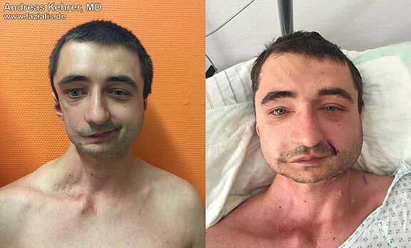 patient_2.jpg 