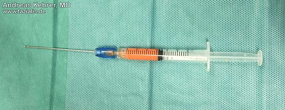 Fetttransplantation_2.jpg 