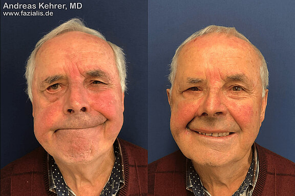 Patient_20.jpg 