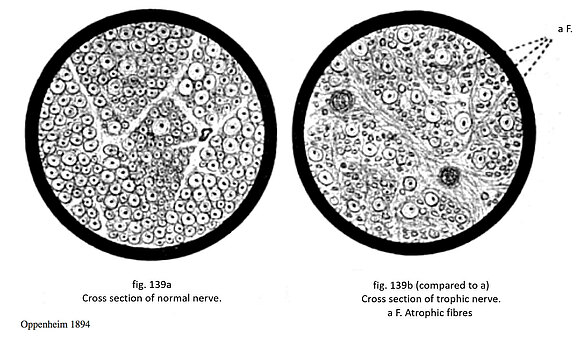 Pathophysiologie_3_eng.jpg 