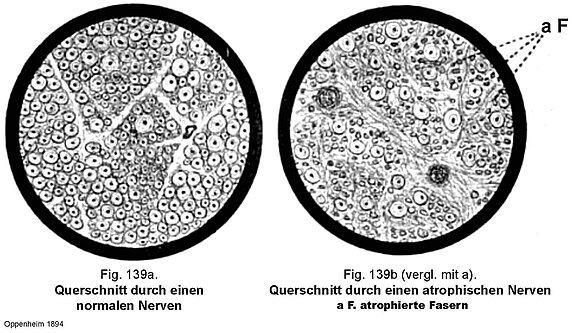 Pathophysiologie_3.jpg 