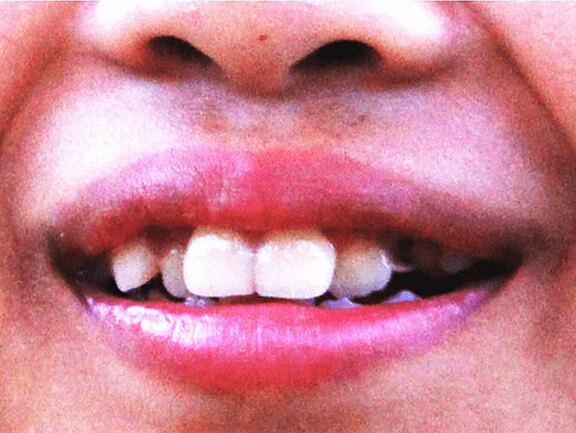 Laecheln_und_Lachen_4.jpg 