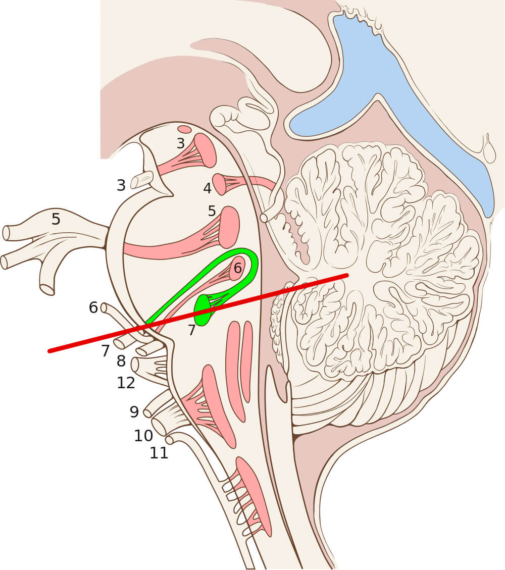 Mandibular nerve (CN V3), Encyclopedia, , Learn anatomy